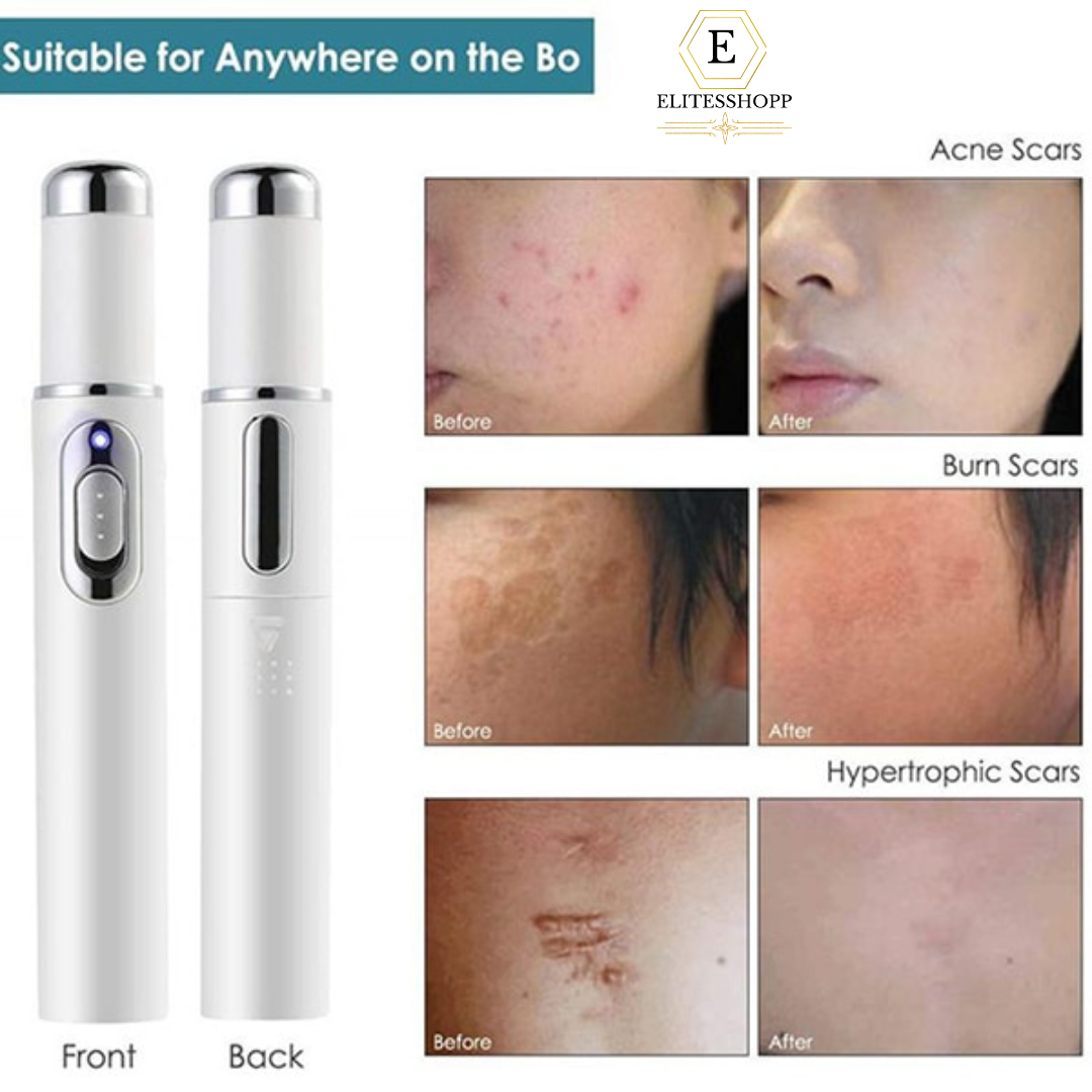 💥Pluma láser💥 Anti-Arrugas, Acné, Manchas De Piel😊