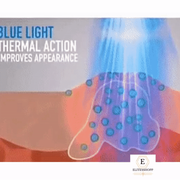 💥Pluma láser💥 Anti-Arrugas, Acné, Manchas De Piel😊